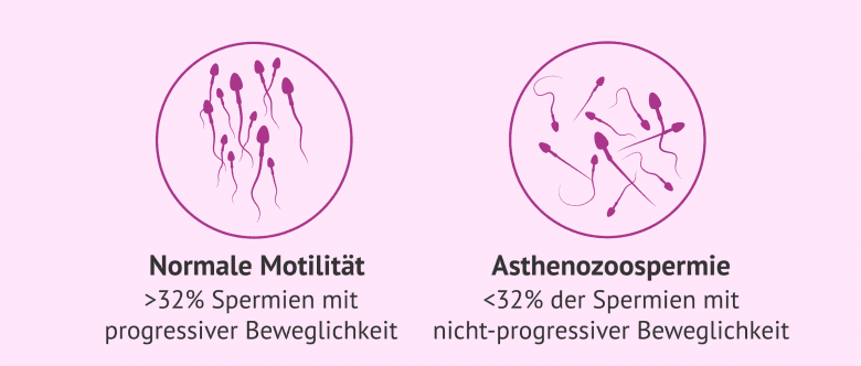 Intrazytoplasmatische Spermieninjektion (ICSI): Ablauf, Kosten Und Erfolg