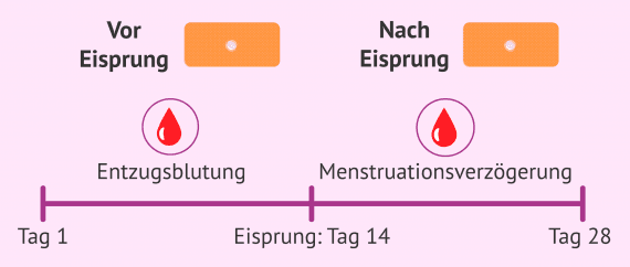 Die Pille Danach Wirkungsweise Und Kosten